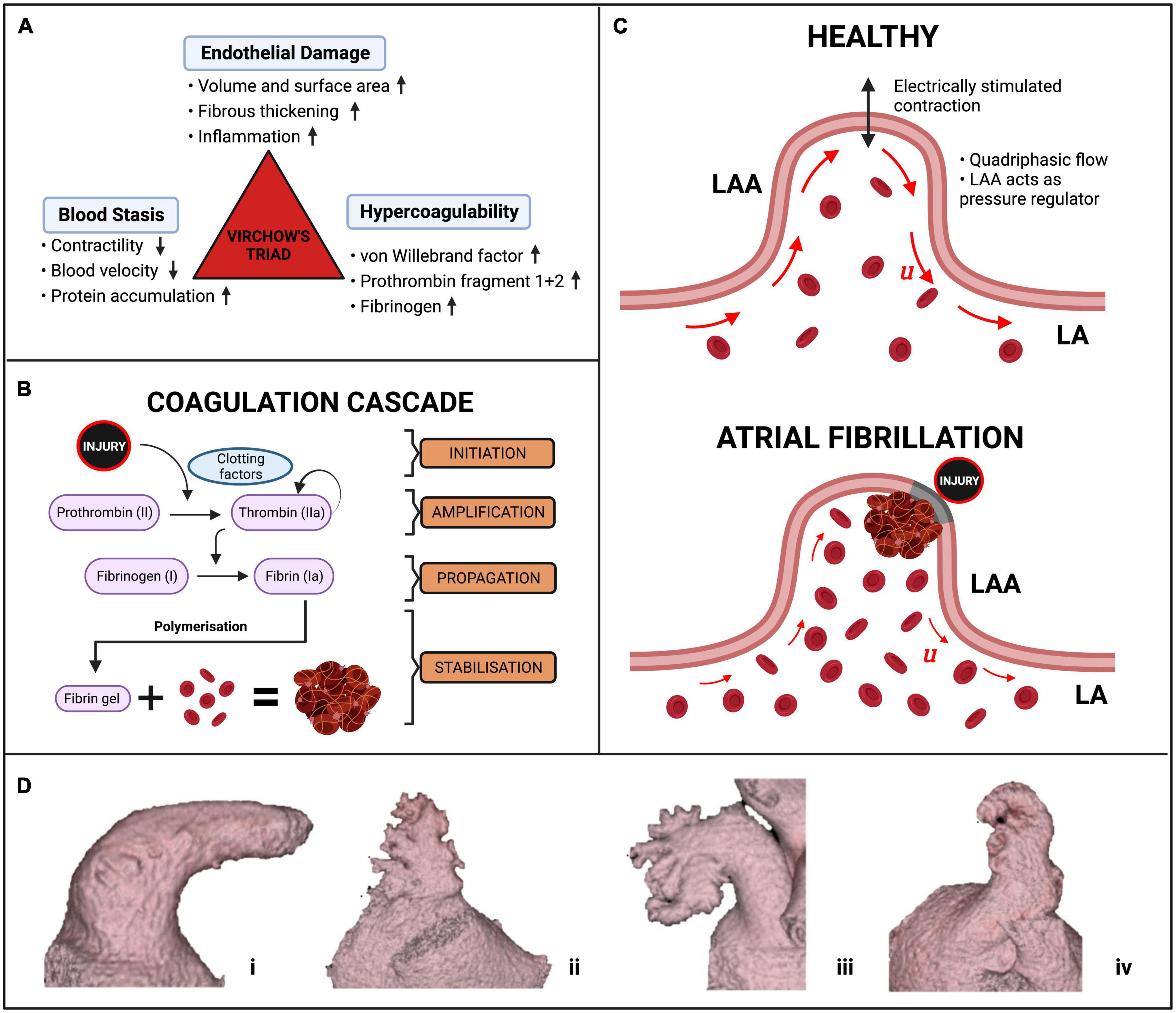 Imaging and biophysical modelling of thrombogenic mechanisms in atrial fibrillation and stroke